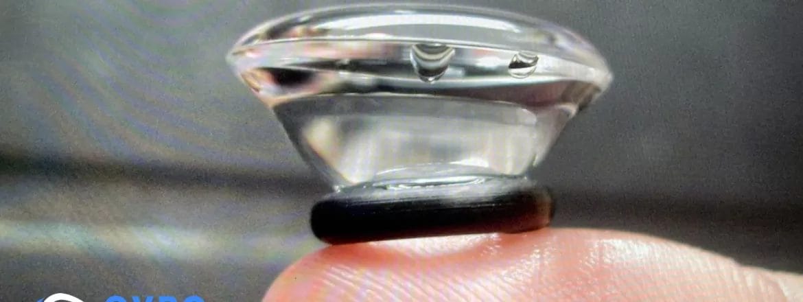 Scleral Lens Dry Eye Syndrome