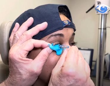 Dr. Boshnick fitting a patient with keratoconus with custom scleral lenses