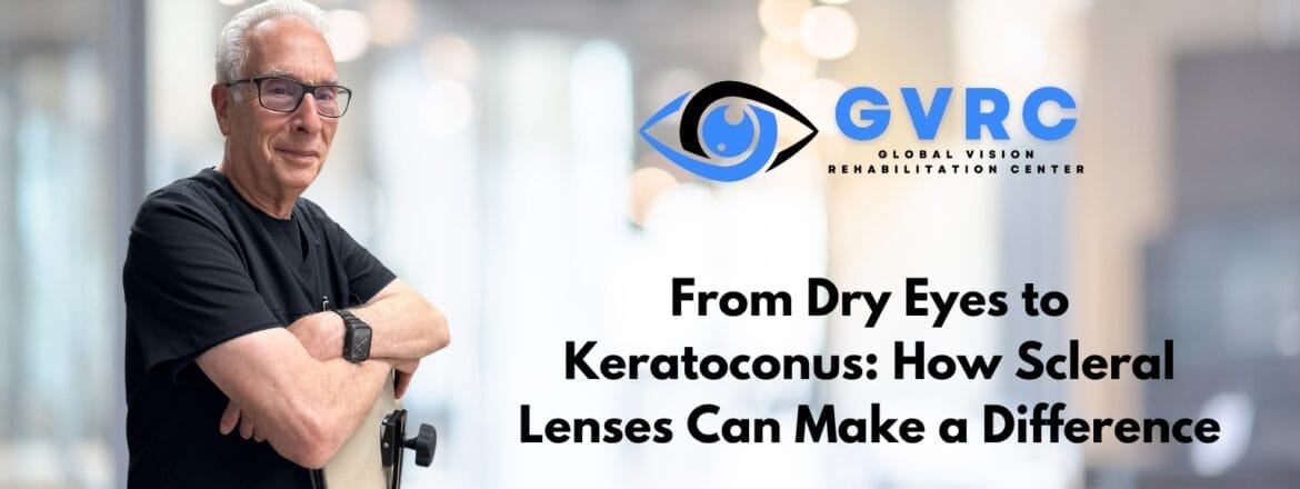 From Dry Eyes to Keratoconus: How Scleral Lenses Can Make a Difference