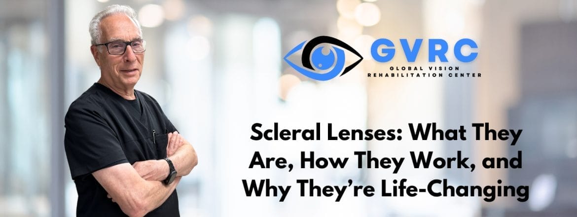 Scleral Lenses: What They Are, How They Work, and Why They’re Life-Changing